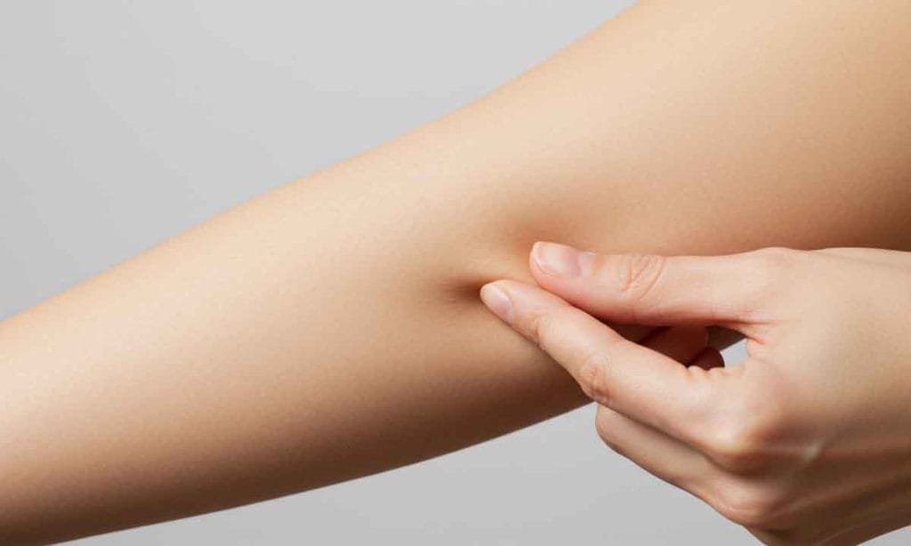 How to Tighten Skin After Weight Loss: Expert Tips and Treatments Why Does Skin Sag After Weight Loss?